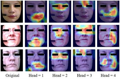 A facial depression recognition method based on hybrid multi-head cross attention network